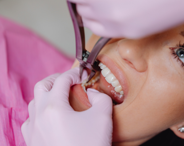 Oral and Facial Maxillofacial Surgeries Bhopal